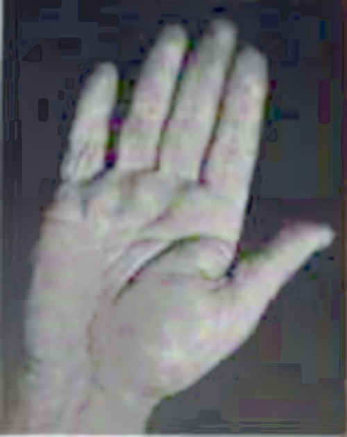 example of a raised puffy prominent lower mars mount zone on the palm in hand reading palmistry